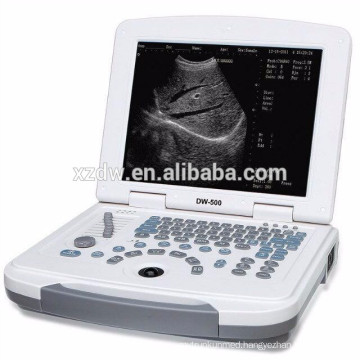 high quality and low price ultrasonic diagnostic devices laptop ultrasound scanner